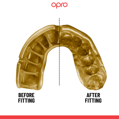 Opro Gold Mouthguard Grillz and Jawz